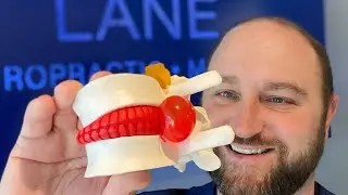 Dr Brent Smarinsky, DC the Chiropractor at Wellness Lane talks about disc bulges and herniations