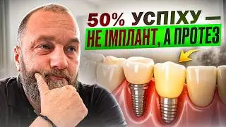 🇺🇦 Почему вокруг импланта исчезает кость или даже трескается сам имплант?