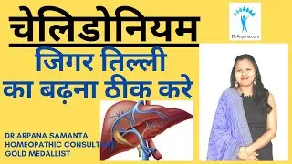 CHELIDONIUM MAJUS Jigar Ki Homeopathic Dawa | Chelidonium Q | Chelidonium Uses | Chelidonium Benefit