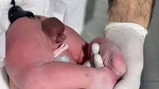 Abdominal distinction suppository procedure for baby compart and medical purposes 