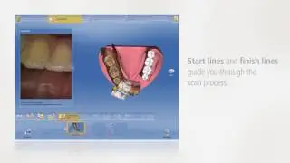 CEREC - Guided scanning