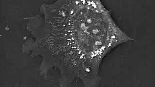 Nanolive imaging: effects of excitation light - with fluorescent marker (MitoNIR)