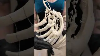 ￼ human ribs with unknown condition