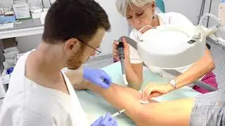 CLaCS: odstraňovanie metličkových žiiek