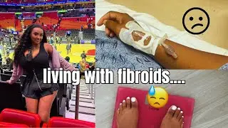 I Have Large Fibroids & Struggle to Lose Weight | How I&rsquo;m Adjusting My Diet to Reduce Bloating