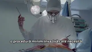 Ce este un defibrilator cardiac intern