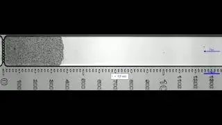 Growth of a yeast clog in a microfluidic chip