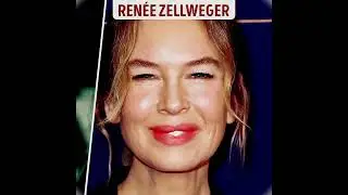 15 celebratey who look strikngly Defferent after cosmetic procedures #15celebraty  #subscribe 