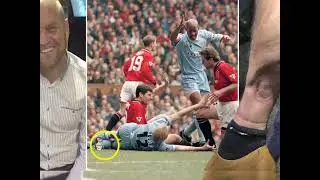 FA Cup quarter-finals: Former Coventry City defender David Busst on the injury that shocked football