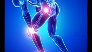 Boswellia: Frankincense For Natural Arthritis, Inflammation, Chronic Pain, and Joint Pain Help