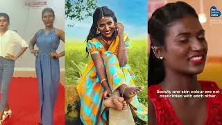 🛑Model San Rechal 26 வயசில் Kidney பாதித்து மறைவு | நடந்தது என்ன? | Black Model San Rechal Throwback
