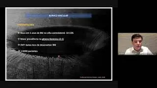 Alterações da Interface Vitreorretiniana - Buraco Macular - Dr. Jacques Houly 08-07-2021
