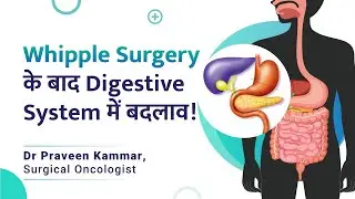 Whipple surgery के बाद Digestive System में बदलाव | Digestive Changes | Dr Praveen Kammar