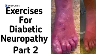Exercises for peripheral neuropathy|peripheral neuropathy exercises for feet@PhysiotherapyTreatments
