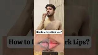dark lips🤔?? Best lipbalm for Dark and pigmented lips