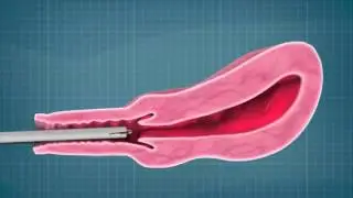 PPIUD Mexico Conference