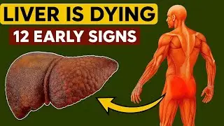 12 Strange Signs Your Liver Is Dying &ndash; Don&rsquo;t Ignore These Warnings!