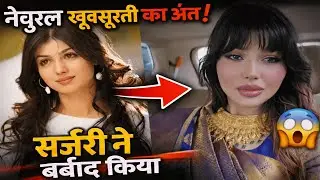 Bollywood Dark Reality 😔 Loss Of Natural Beauty 🙁