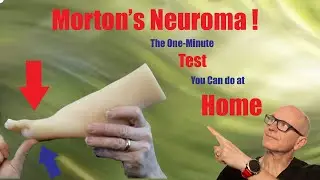 This test will tell you if you have Morton's neuroma