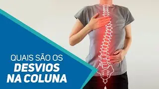 TIPOS DE DESVIO NA COLUNA l PILLOWMED l SHOW DA SAÚDE