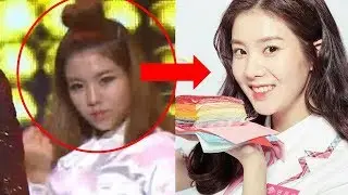IZ*ONE's Kwon Eunbi Underwent Plastic Surgery?