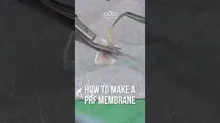 How to make a PRF Membrane #prf