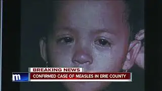 Confirmed case of measles in Erie County