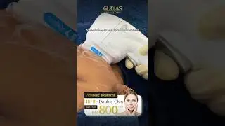 𝗔𝗲𝘀𝘁𝗵𝗲𝘁𝗶𝗰 Clinic Kuala Lumpur | HIFU Treatment: Smooth and Define Your Chin!