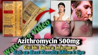 Azibact 500mg Uses in Hindi! Azithromycin 500mg! Side Effects! Benefits! Doses! Uses#azithromycin500