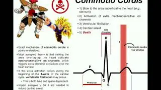 The Mechanism of Commotio Cordis