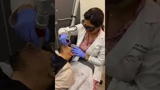Tri-Beam Laser: The Ultimate Treatment for Skin Lightening, Pigmentation, and Glowing Skin!