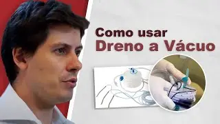 Orienta&ccedil;&otilde;es para o uso de Dreno a V&aacute;cuo