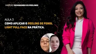 AULA 3: Como aplicar peeling de fenol light full face na prática.