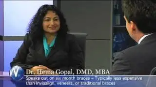 Six Month Braces - Dr. Hema Gopal