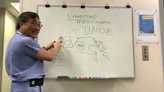 Кавернозные гемангиомы, транзиторная ишемическая атака и риск инсульта