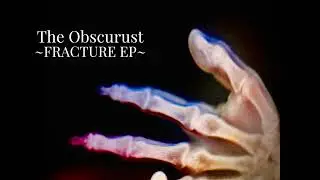 Heroic Doses - THE OBSCURUST