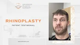 Rhinoplasty (nose job) | Real Patient Testimonial-Dr. Ewa Timek | Grand Rapids, MI
