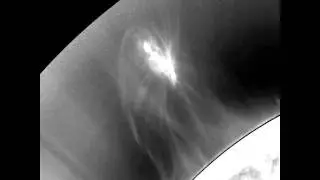 SDO/AIA Artificial Coronagraph Highlight for 2011/11/14
