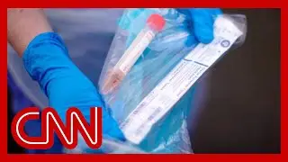 US overtakes Italy in total coronavirus cases