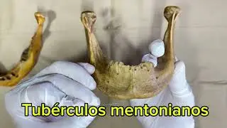 💀ANATOMÍA MANDÍBULA / Hueso mandibular fácil ¡Todo lo que tienes que saber!