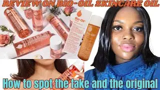 Review On Bio-Oil Skincare Oil✨It&rsquo;s Amazing Benefits On The Skin//How To Spot The Fake & Original