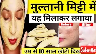 मुल्तानी मिट्टी में सिर्फ यहचीज लगालगाआपकाफेस पर टैनिंग पिगमेंटेशन है पिंपल सारे एकदम क्लियरकर देगा