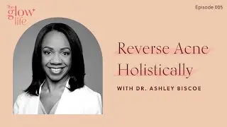 Reverse Acne Holistically with Dr. Ashley Biscoe