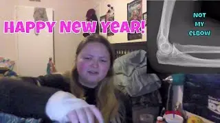 I broke my elbow/ Happy one year Youtubeversary