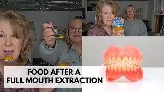 Food Ideas after Full Mouth Teeth Extraction or Immediate Dentures