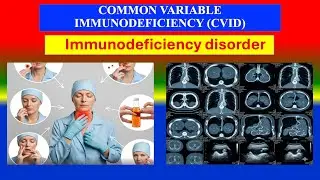 COMMON VARIABLE IMMUNODEFICIENCY (CVID) Explained | Causes, types, Symptoms, Diagnosis & Treatment&rdquo;