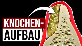 Implantate: Knochenaufbau einfach erkl&auml;rt!