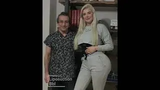 Brazilian Butt Lift Turkey (BBL) - Zty Health