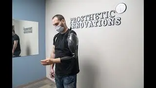 Steeper Espire Pro Myo Electric Elbow | Linear Transducer | Prosthetic Innovations