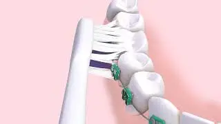GUM&reg; SONIC ORTHO Toothbrush: 45% Superior Clean & 86% Thorough Cleaning for Braces